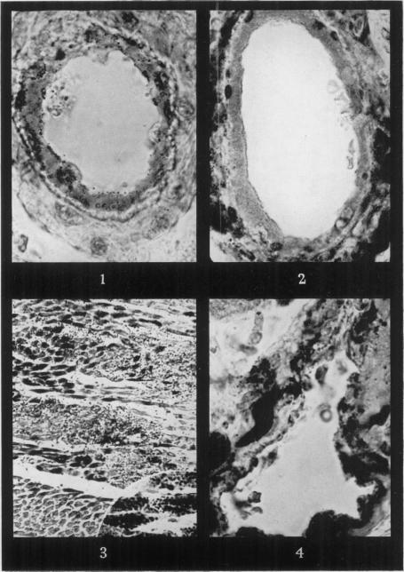 Figs. 1-4