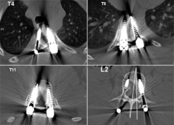 Figure 12