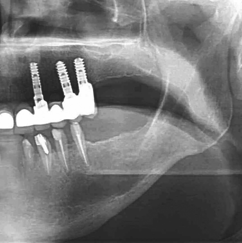 Figure 1