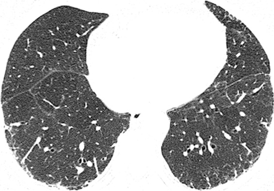 Figure 4c: