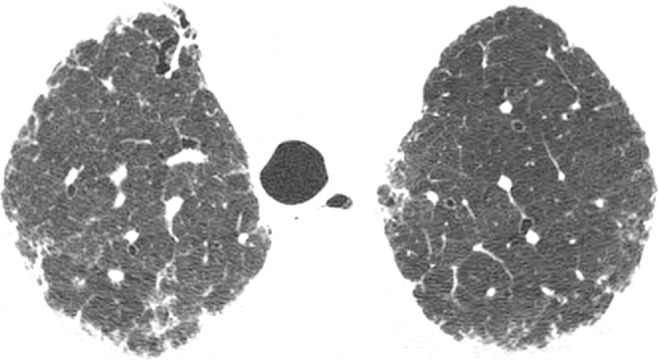 Figure 4d: