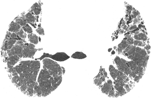 Figure 4e: