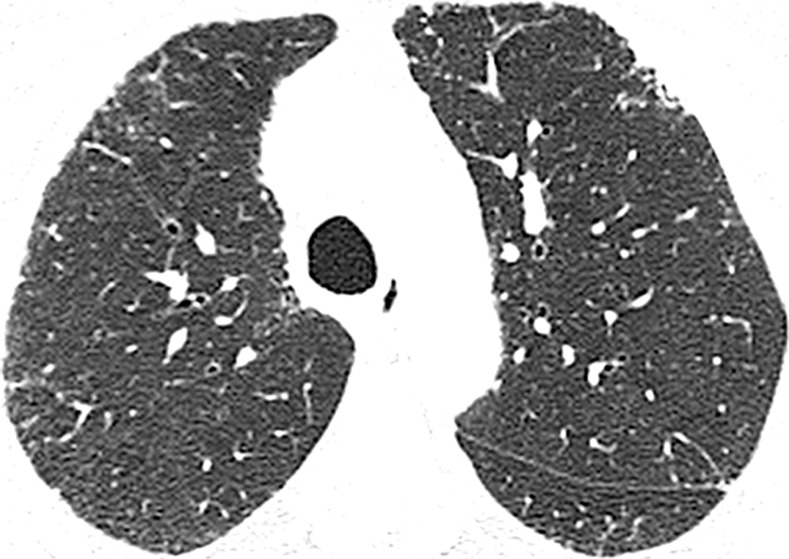 Figure 4a: