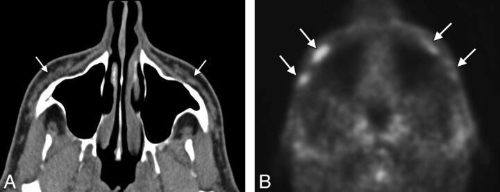 Fig 2.