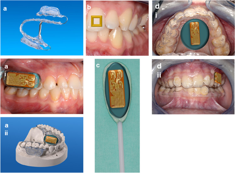 Fig. 3