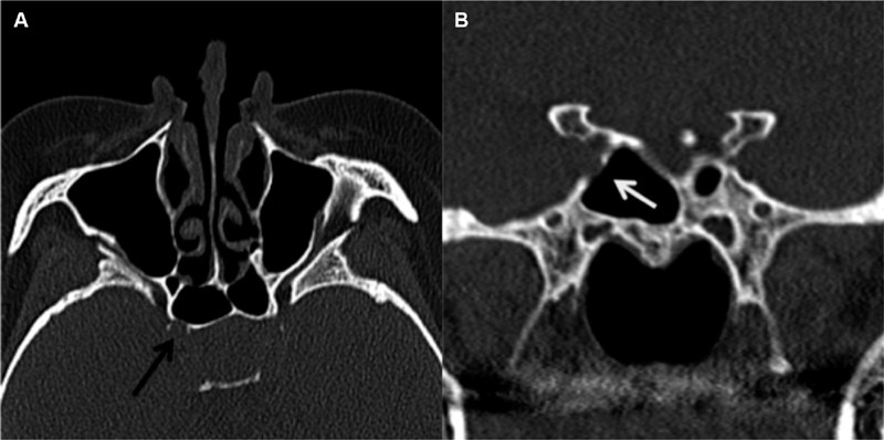 Fig. 10