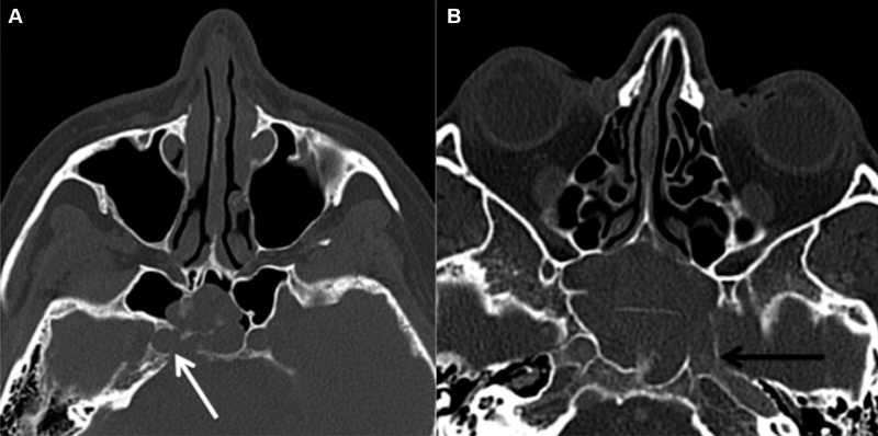 Fig. 11