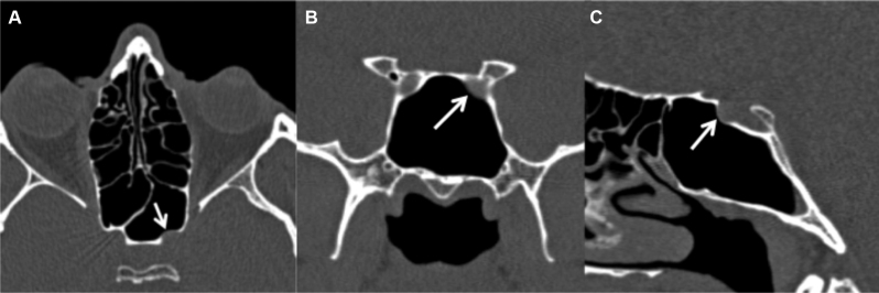 Fig. 9