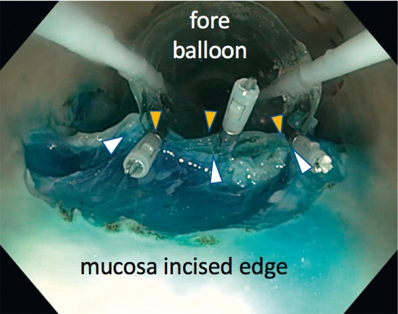 Fig. 2