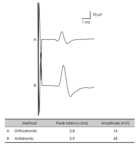 Fig. 11