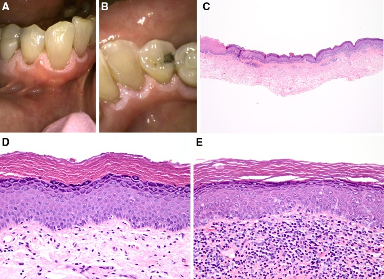 Fig. 16