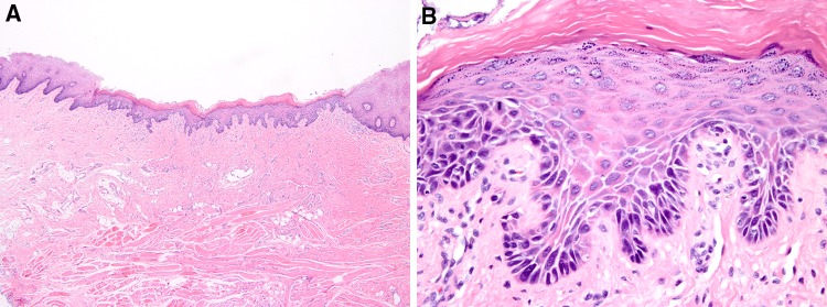 Fig. 17