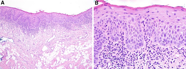 Fig. 26