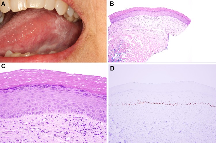 Fig. 24