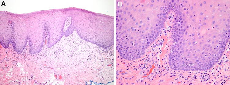 Fig. 10