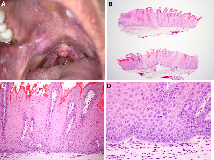 Fig. 13