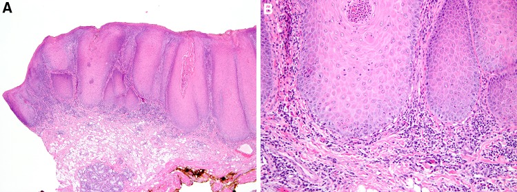 Fig. 15