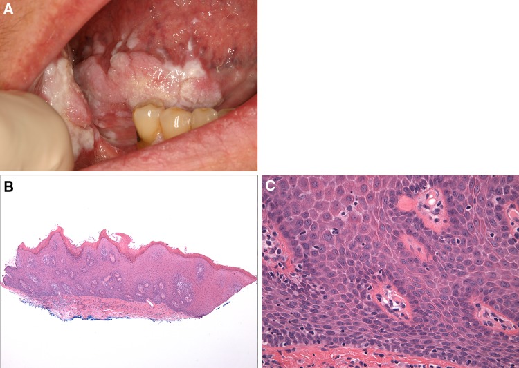 Fig. 12