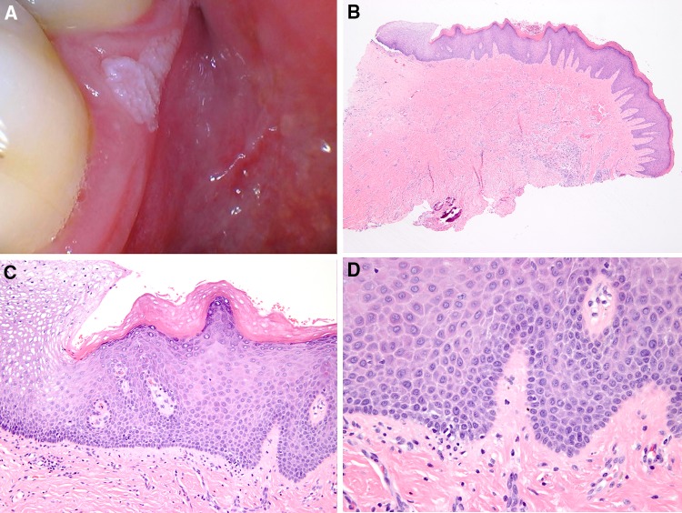 Fig. 19