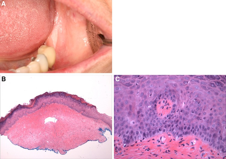 Fig. 11