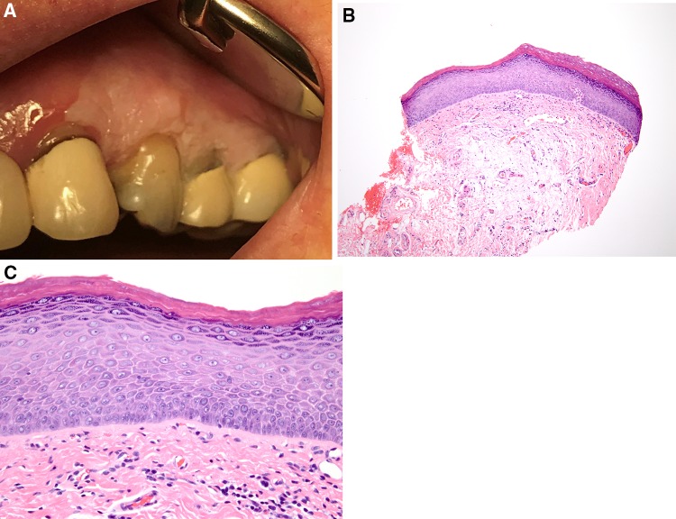 Fig. 23