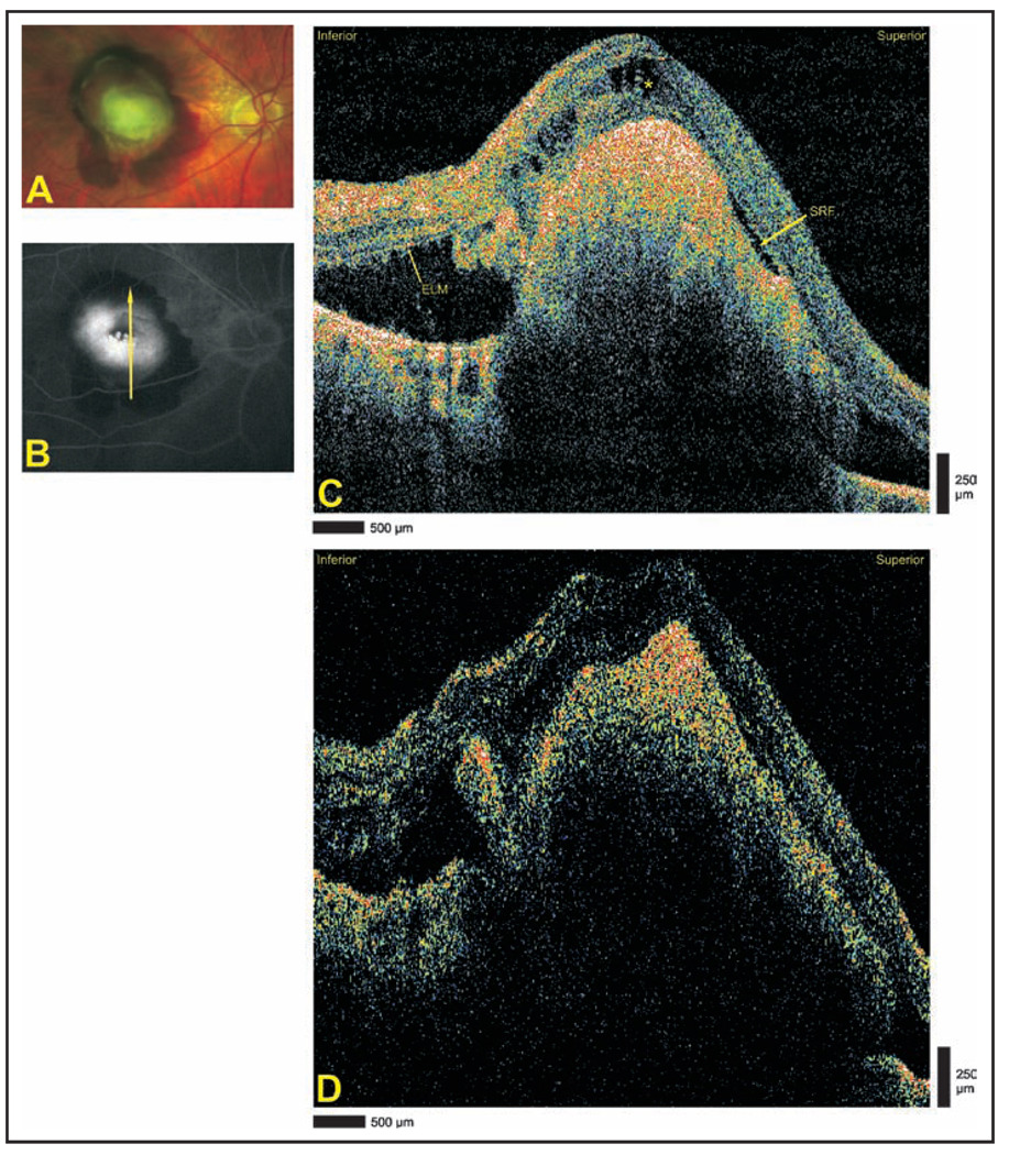 Figure 5