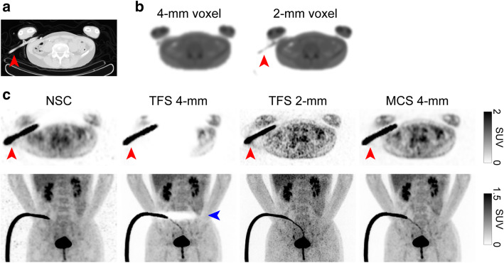 Fig. 3
