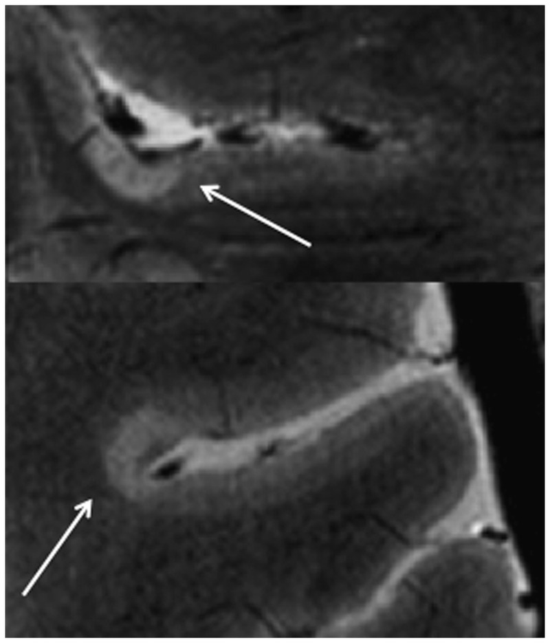 Figure 9-12