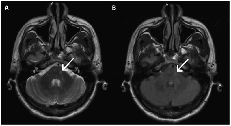 Figure 9-5