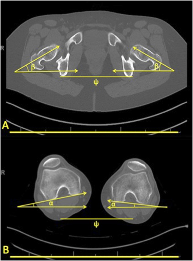 Fig. 2A-B