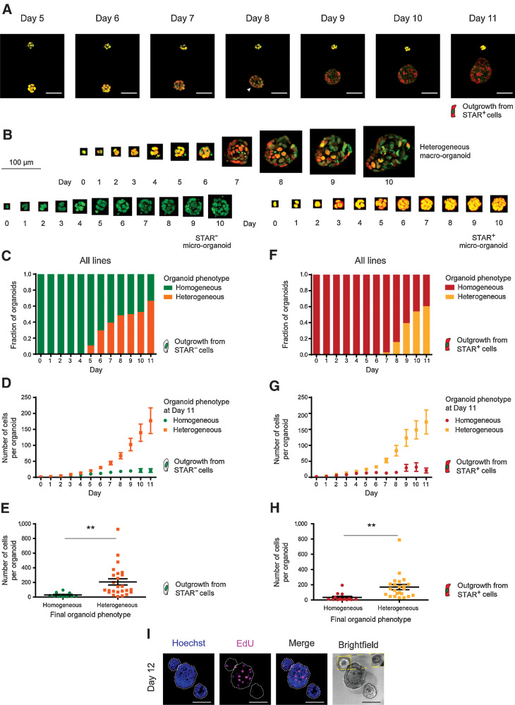 Figure 3. CRC organoids phenocopy the cellular dynamics during metastatic outgrowth. A, Stills from live-cell recordings of A/K/P/S–mutant organoid formation (day 5 to 11) from single nuclear STAR+ cells (red). Top, organoid fails to establish heterogeneity and stagnates in growth. Bottom, organoid develops cellular heterogeneity indicated by varying STAR levels and continues to grow. Nuclei are marked with a chromatin tag (green). Color hues are red/green overlaid (resulting in yellow to dark orange). Arrowhead, symmetry break. Scale bars, 50 µm. B, 3D-rendered pictures of single cells growing into either a heterogeneous organoid (top) or into homogeneous STAR− (bottom left) or STAR+ (bottom right) micro-organoids. Nuclei (green), STAR (nuclear, red), overlay (yellow). Scale bar, 100 µm. C–H, Pooled data of four human colorectal cancer organoid lines: Engineered APCKO/KO/KRASG12D/–/TP53KO/KO (A/K/P), APCKO/KO/KRASG12D/–/TP53KO/KO/SMADKO/KO (A/K/P/S), PDO P16T, and PDO P19bT. Data are stratified by STAR identity at the time of plating. (C–E/F–H) Outgrowth of STAR−/STAR+ cells with homogeneously STAR− (green)/STAR+ (red) organoids and heterogeneous organoids (orange/yellow). C and F, Graph representing the fraction of organoid phenotypes per indicated time point during the outgrowth of STAR–/STAR+ CRC cells. D and G, Graph representing the size (mean cell number + SEM) of developing organoids from single STAR–/STAR+ cells, stratified by final phenotype. E and H, Organoid size per final phenotype for the outgrowth of single STAR–/STAR+ cells. Two-tailed Student t test (P value 0.0070/0.0045) indicates significant difference. I, Three 12-day-old organoids with EdU incorporation (pink) to label proliferative cells. Counterstain Hoechst 33342 (blue). Selection (yellow) shows optimal bright-field cross-section. Scale bars, 100 µm.