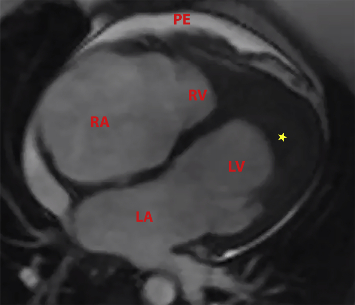 Figure 2