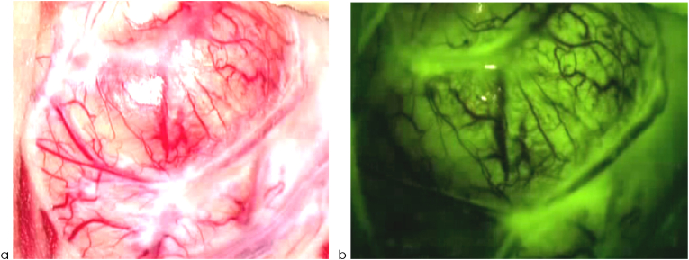 Fig. 4a