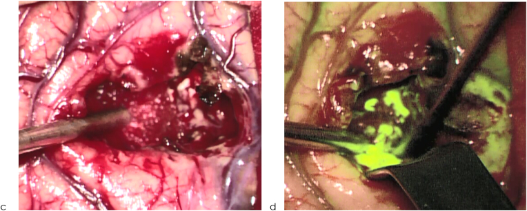 Fig. 4b