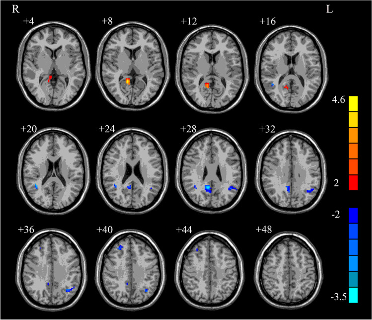 Fig. 2