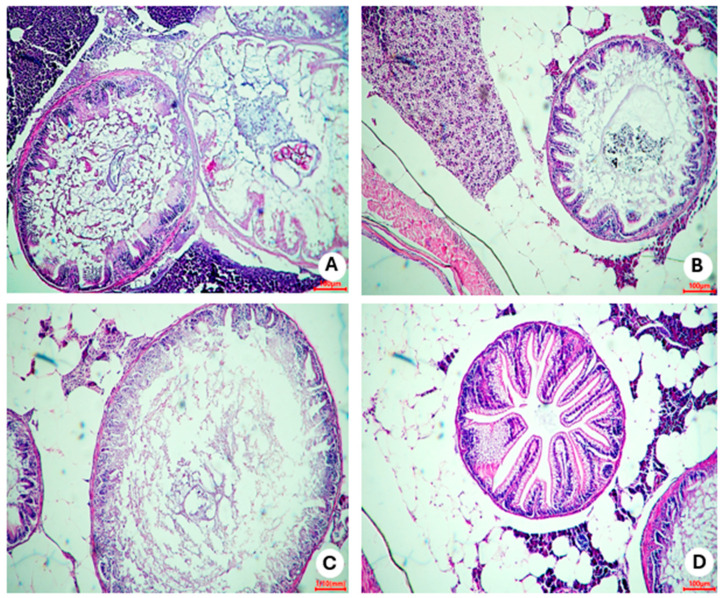 Figure 14