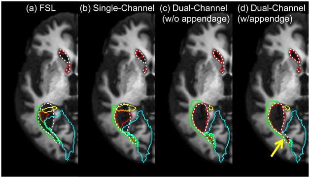 Figure 4