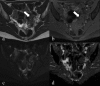 Figure 11.