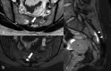 Figure 15.