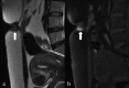Figure 13.
