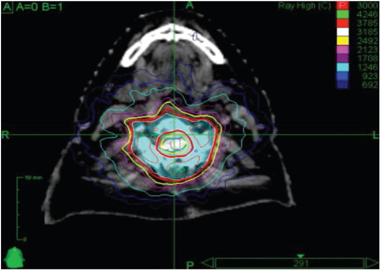 Fig. 1