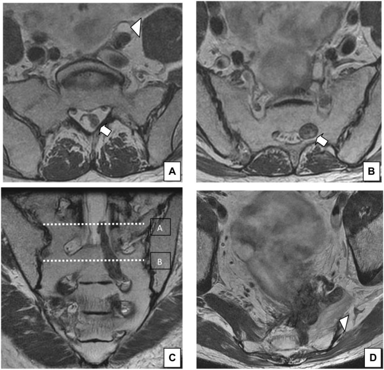 Figure 11