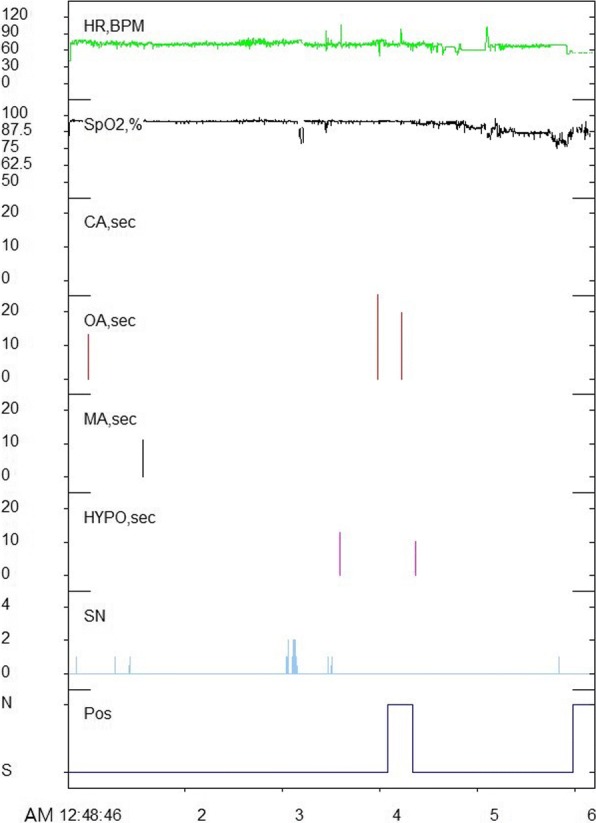 Fig. 4