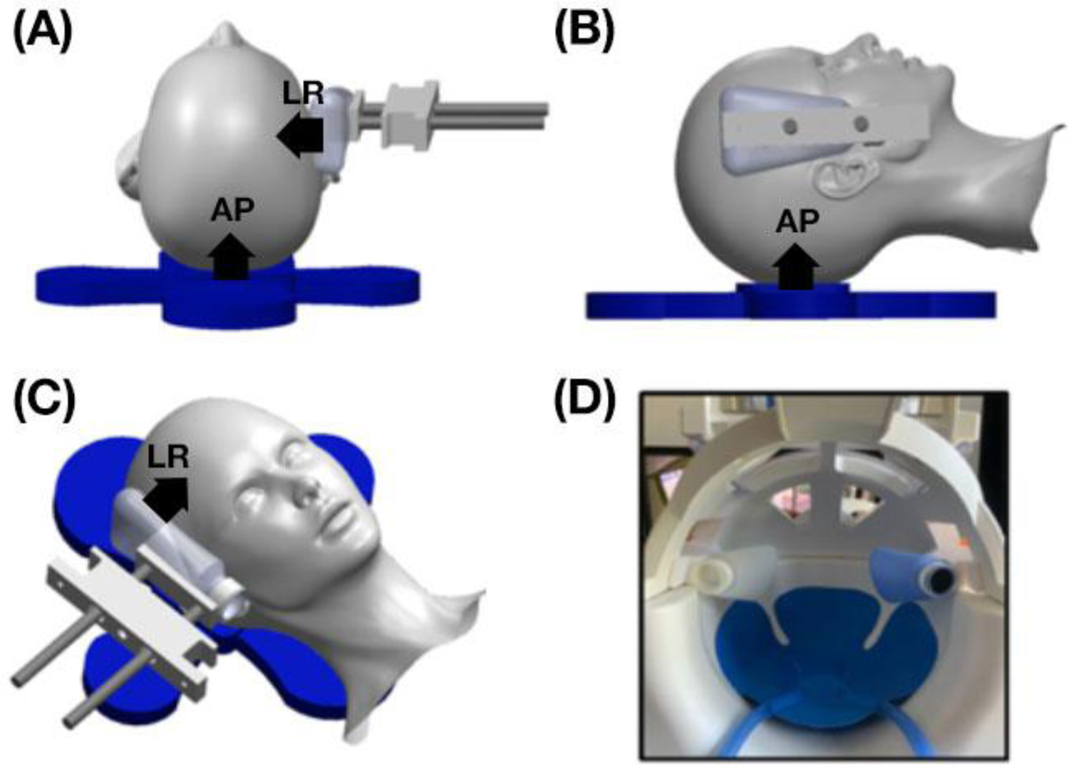 Figure 1: