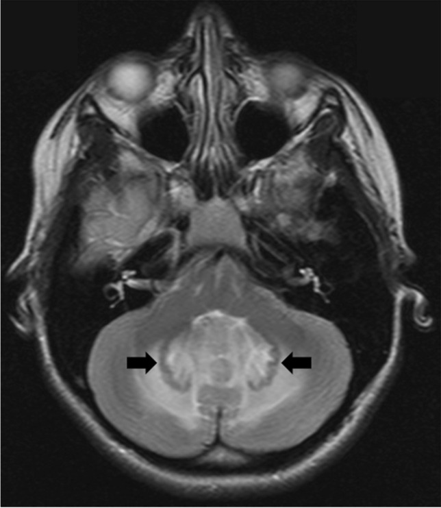 Fig. 5