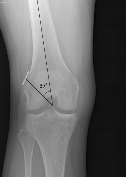 Fig. 1