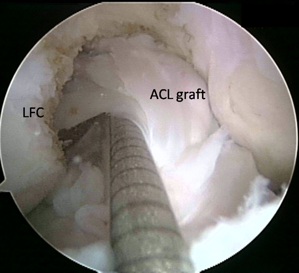 Fig. 2