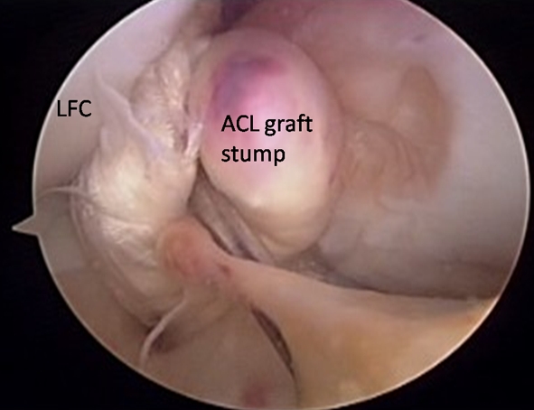 Fig. 3