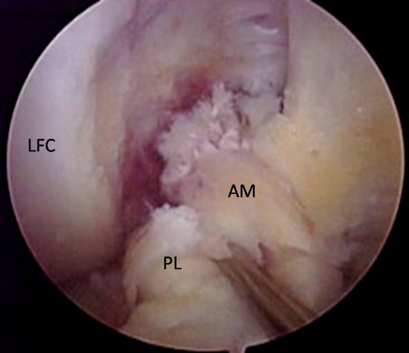 Fig. 6