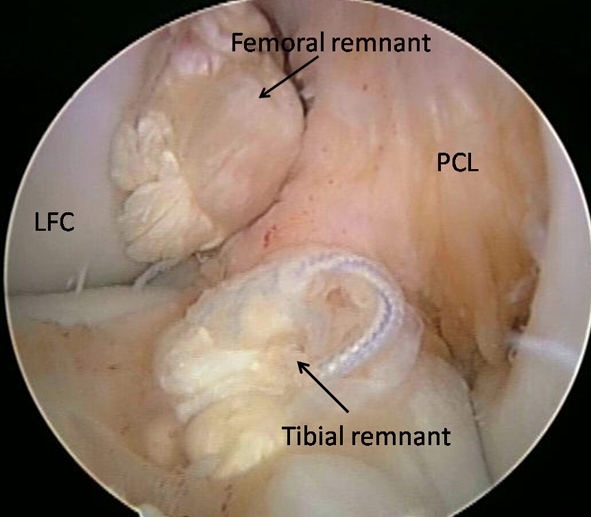 Fig. 4